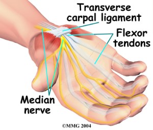 carpal-tunnel
